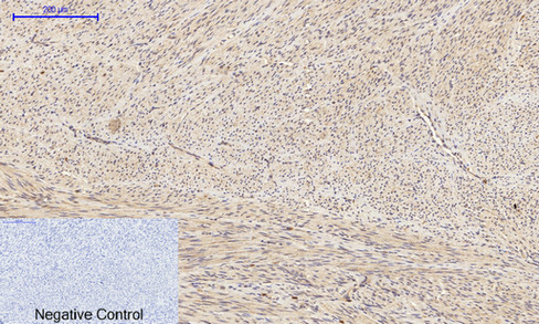 IHC - Bad Polyclonal Antibody AP68618